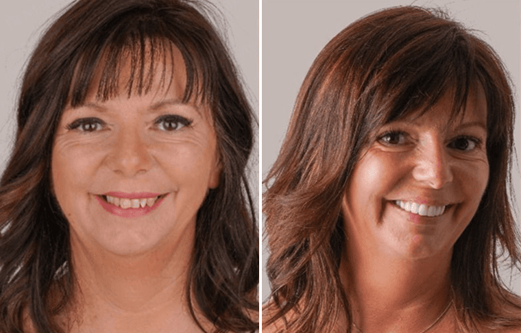 Dental Care