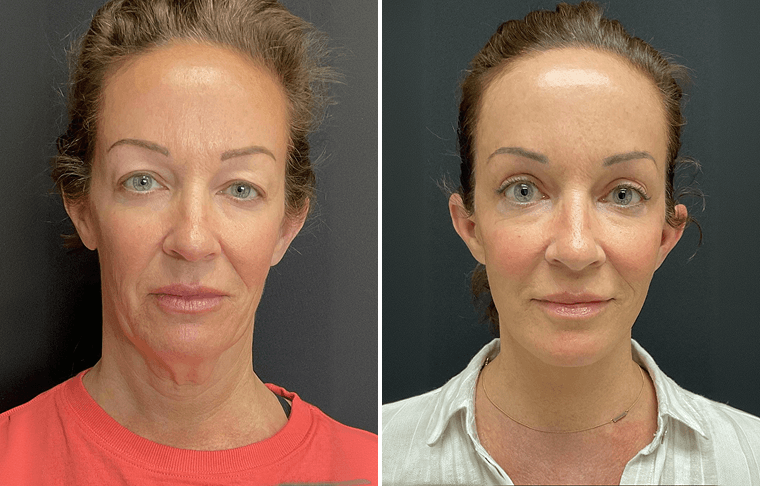 Aesthetic Surgery
