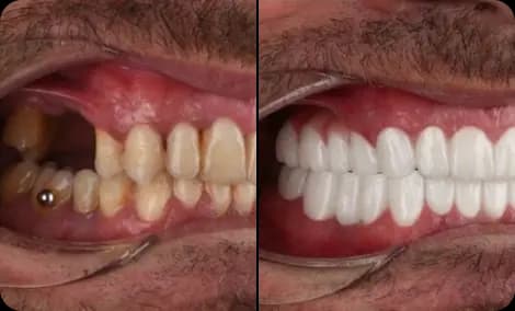 Marcus from Manchester before and after result