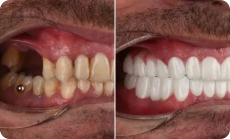 Marcus from Manchester before and after result
