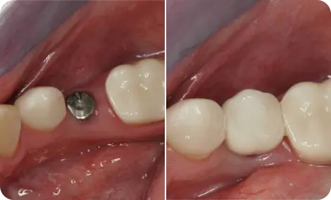 Rafael from Bucharest before and after result